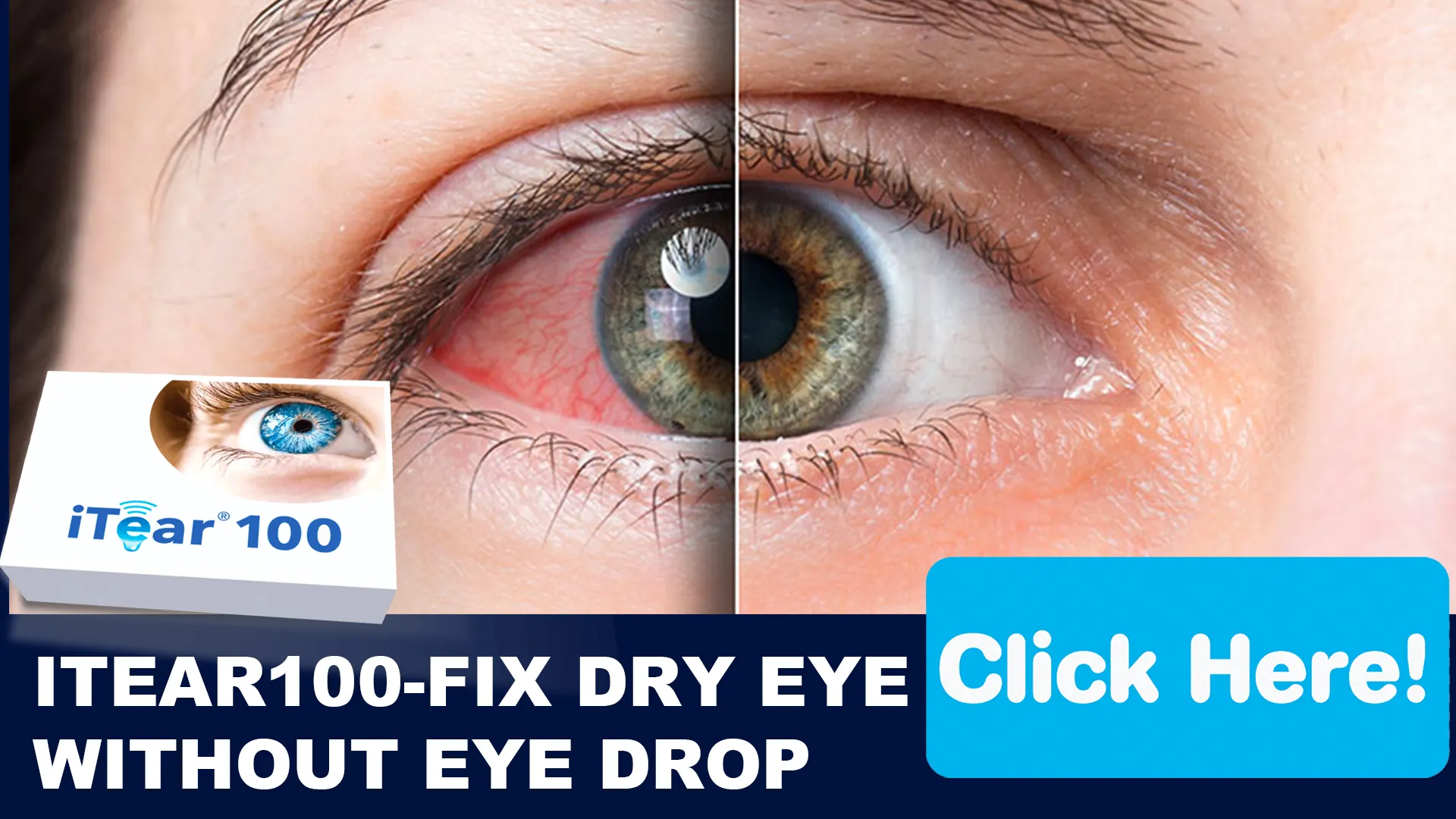 Understanding Dry Eye: An Overview for Parents