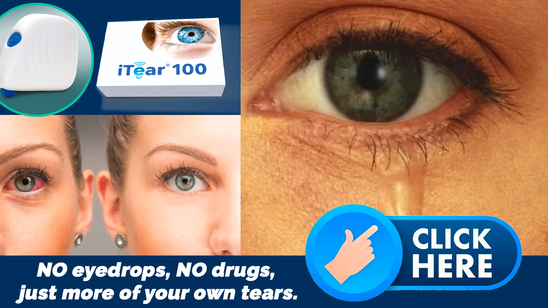 iTEAR100: A Drug-Free Solution to Dry Eyes